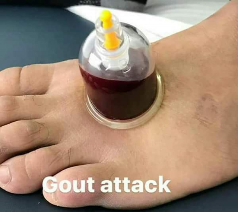 First slide