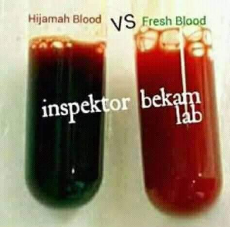 First slide