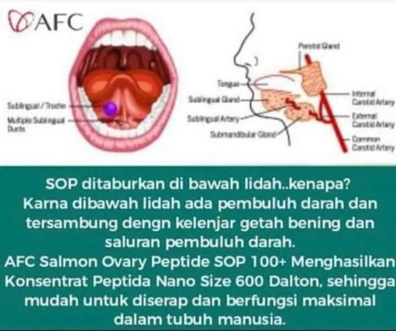 First slide